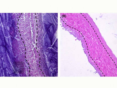 Микрофотографии синтезированных биоматериалов на основе: а) перикарда, б) глиссоновой капсулы печени © Polymer International / Wiley
